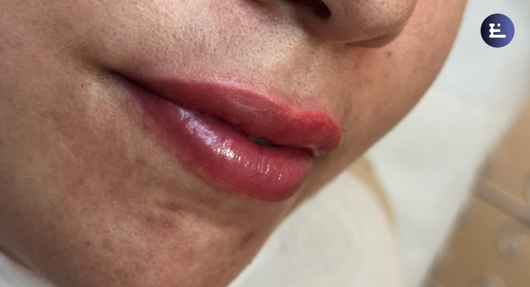 After - Professional Lip Blush